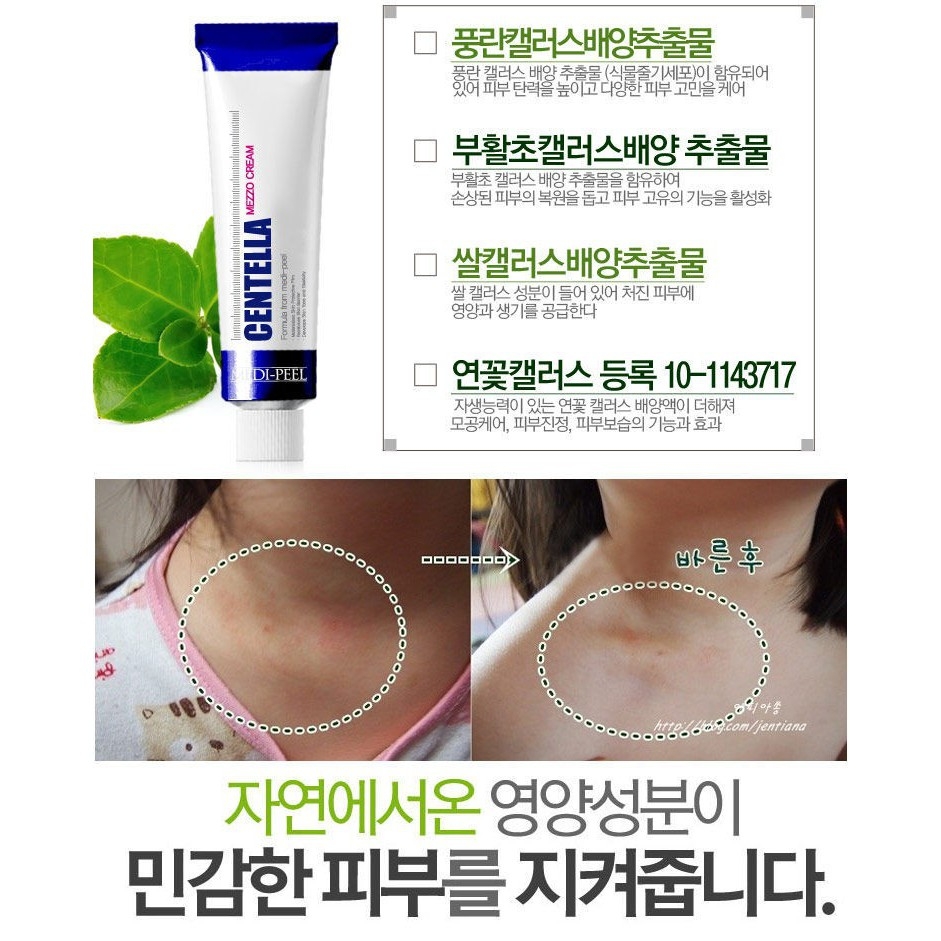 Miếng dán mụn cosrx-hàn