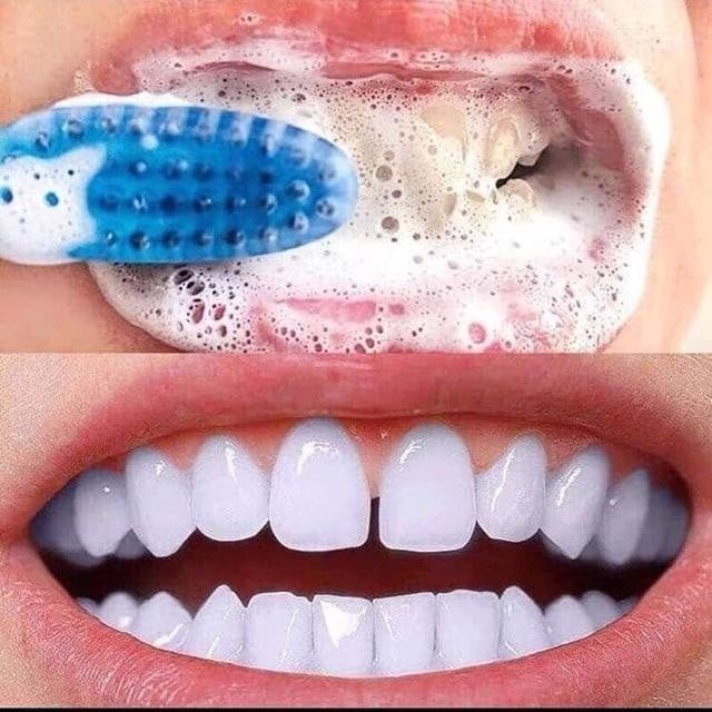 Kem đánh răng làm trắng Median Dental IQ White 93% 120g