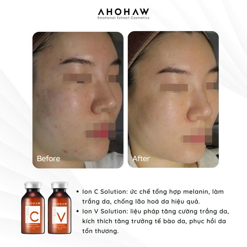 Tế Bào Gốc Phục Hồi Da AHOHAW IONS V (20ml/ Lọ)