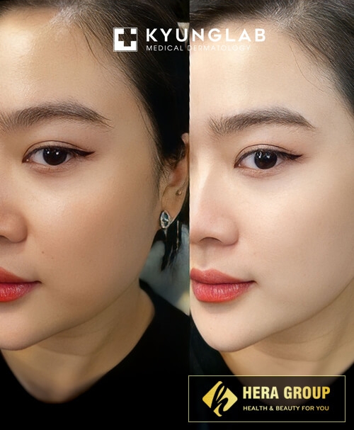 Kem dưỡng ngày nâng tone tự nhiên DAY DREAM KyungLab