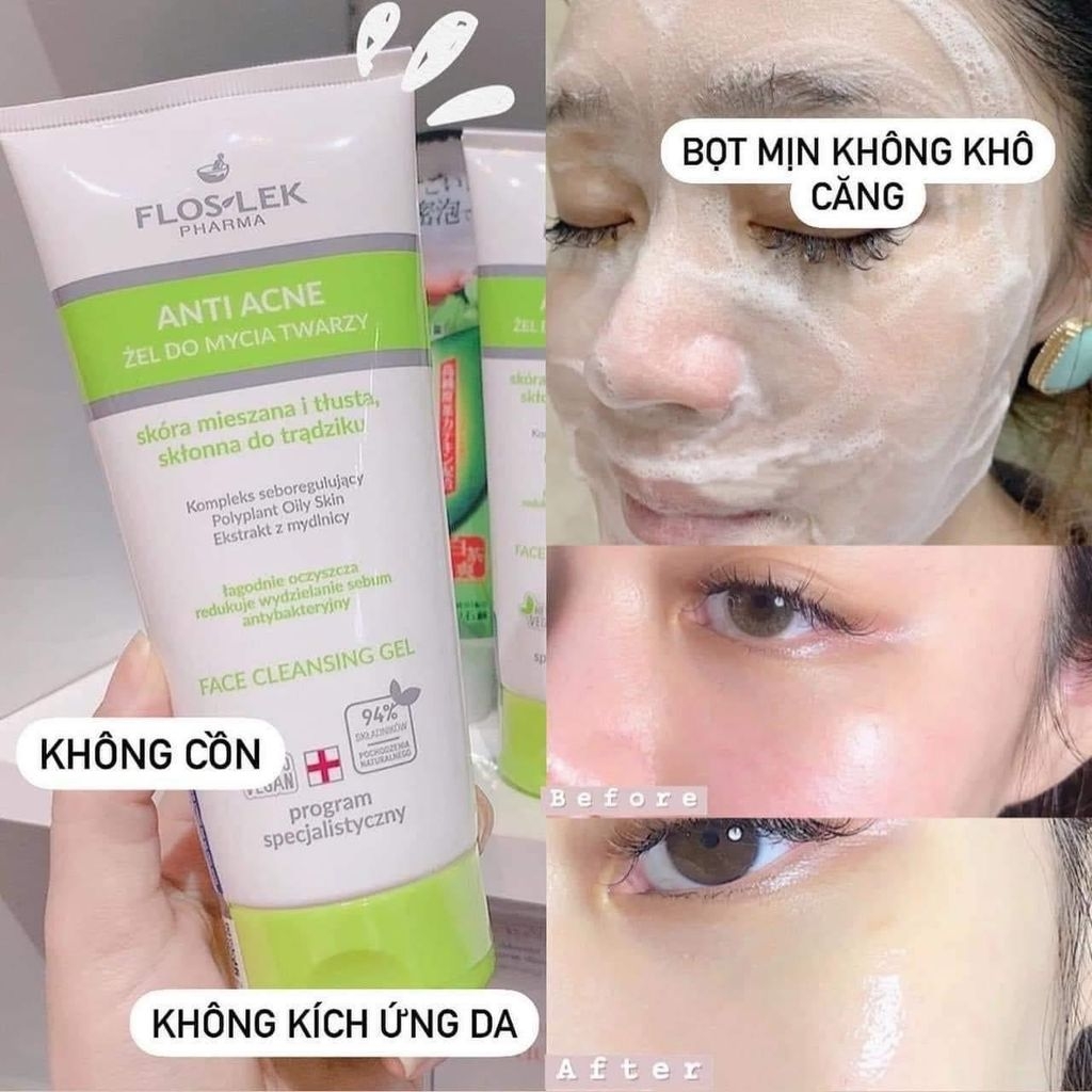 sữa rửa mặt Floslek Anti Acne Face Cleansing Gel-ba lan