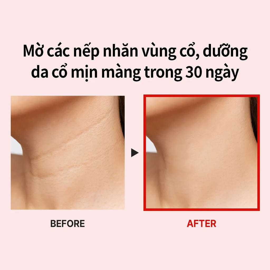 Kem Dưỡng Chống Lão Hóa Vùng Cổ Medi-Pee-hàn