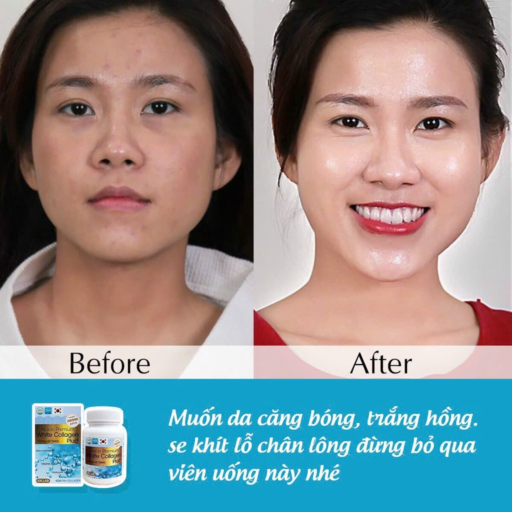 Viên uống Trắng Da Collagen Kn.Lab 60 viên (100ea)-hàn