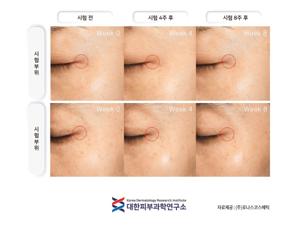 Tinh chất Filler Vitamin C 13.5% LAVASOME  10 ống x 5g  Hàn Quốc