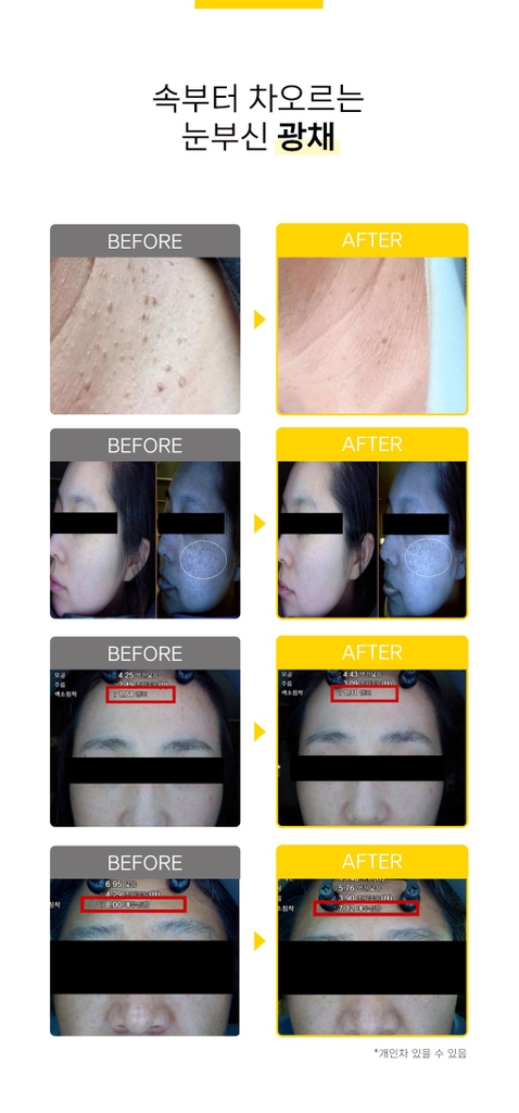 Tinh chất Filler Vitamin C 13.5% LAVASOME  10 ống x 5g  Hàn Quốc