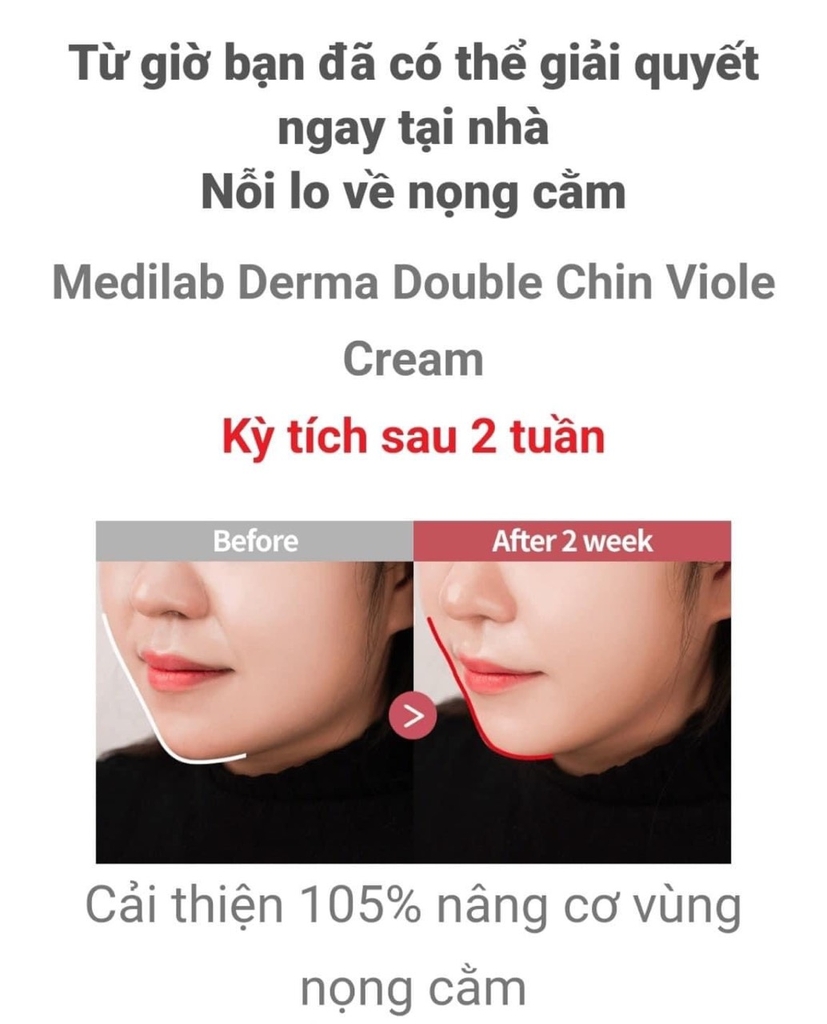 Kem nâng cằm V-line Medilab Derma DCA Double Chin V Lifting Cream 50ml-hàn