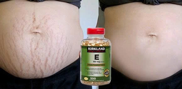 Viên uổng bổ sung Vitamin E 400 IU KirklLAND-500 viên Mỹ