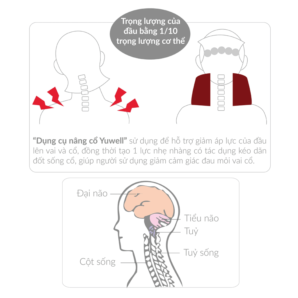 Đai cổ hơi kéo giãn cổ - Thiết bị nâng cổ hơi - Dụng cụ nâng cổ YUWELL TYPE B