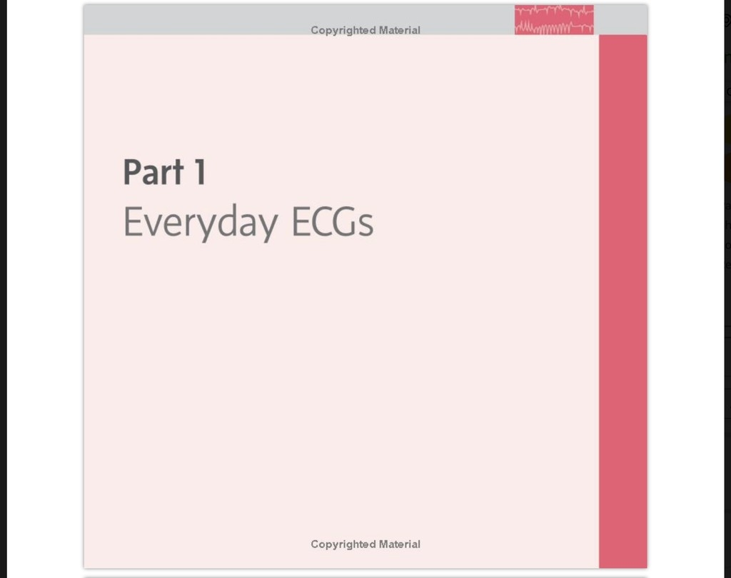 Sách ngoại văn 150 ECG Cases 5th
