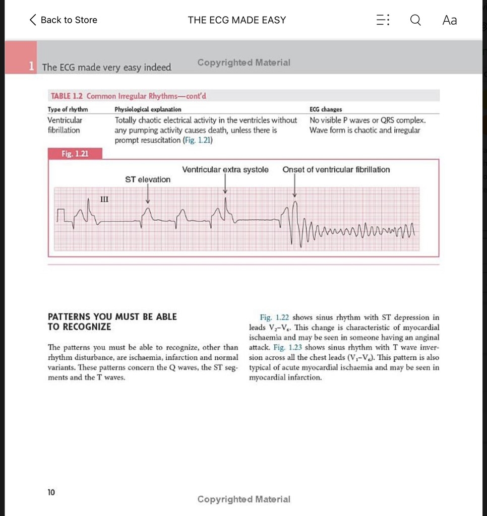 Sách ngoại văn The ECG Made Easy 9th