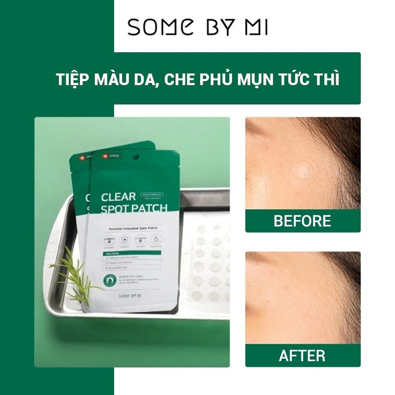 Miếng Dán Mụn Some By Mi Clear Spot Patch 18 Miếng
