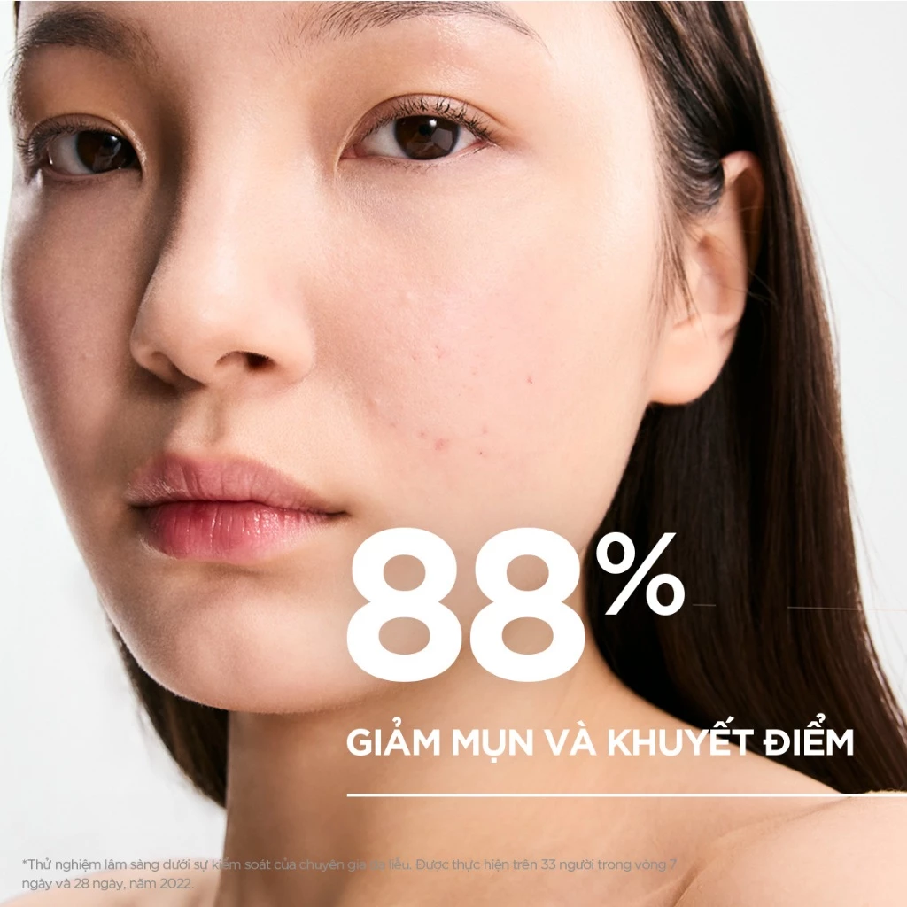 Serum Bioderma Sébium Serum Sáng Mịn, Mờ Thâm Cho Da Dầu Mụn 30ml