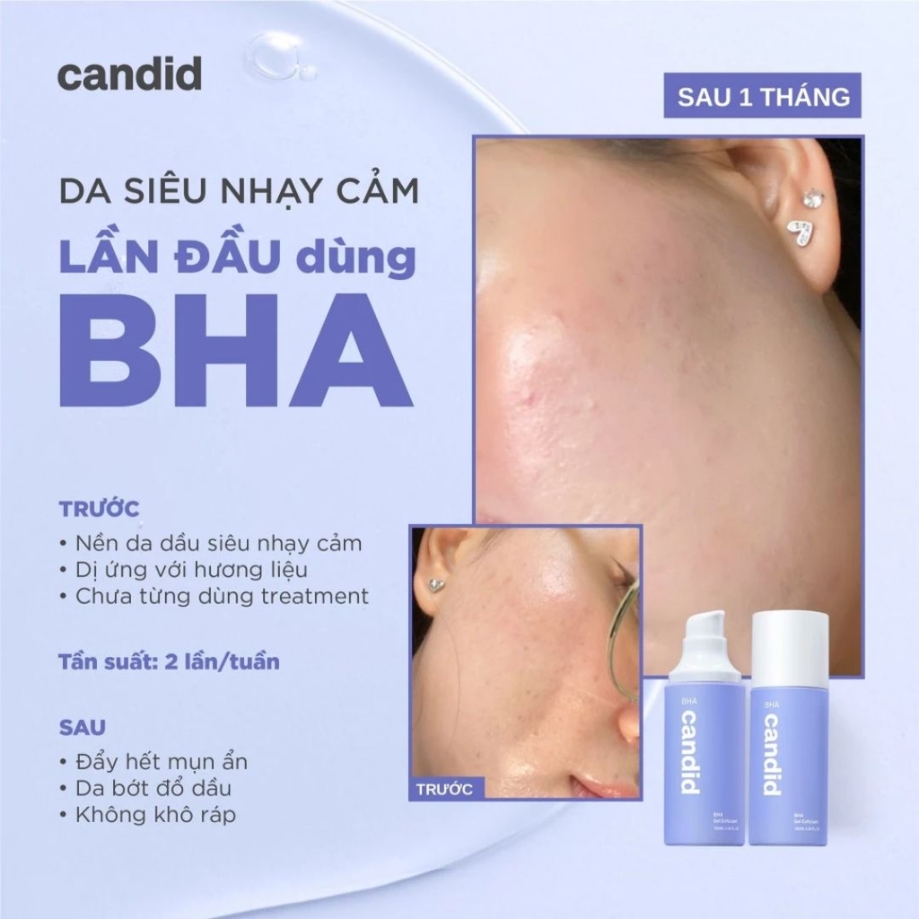 Gel Tẩy Tế Bào Chết Da Dầu Candid BHA Gel Exfoliant