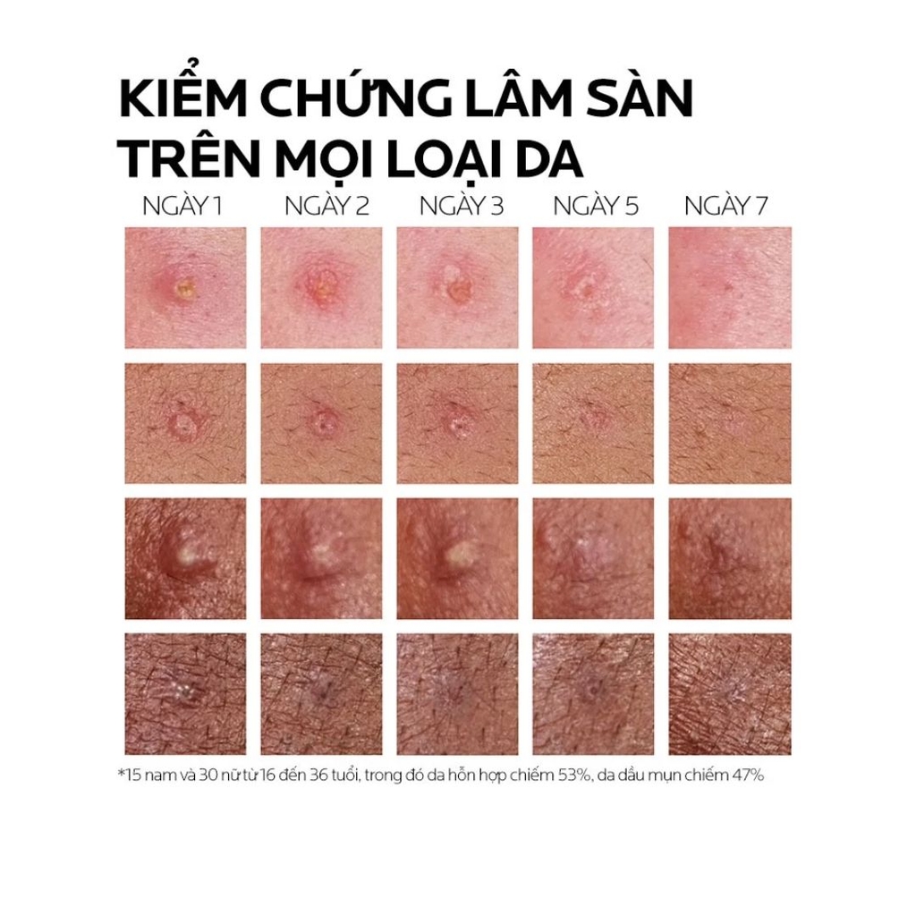 Kem Dưỡng Giảm Mụn Nhanh 8 Giờ & Ngừa Mụn Tái Phát La Roche-Posay Effaclar Duo+ M