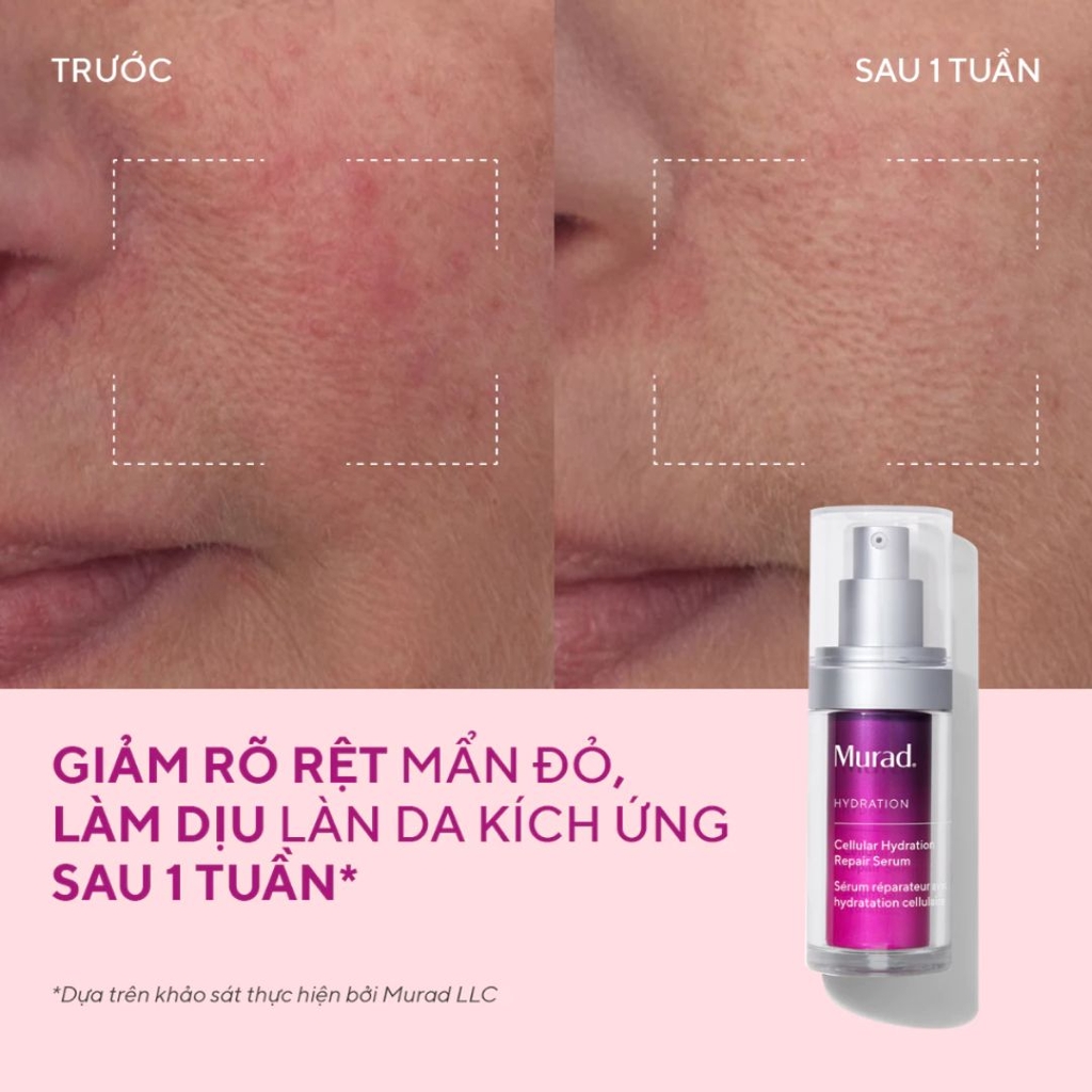 Serum Phục Hồi Hàng Rào Bảo Vệ Da & Cấp Ẩm Tế Bào Murad Cellular Hydration Repair Serum