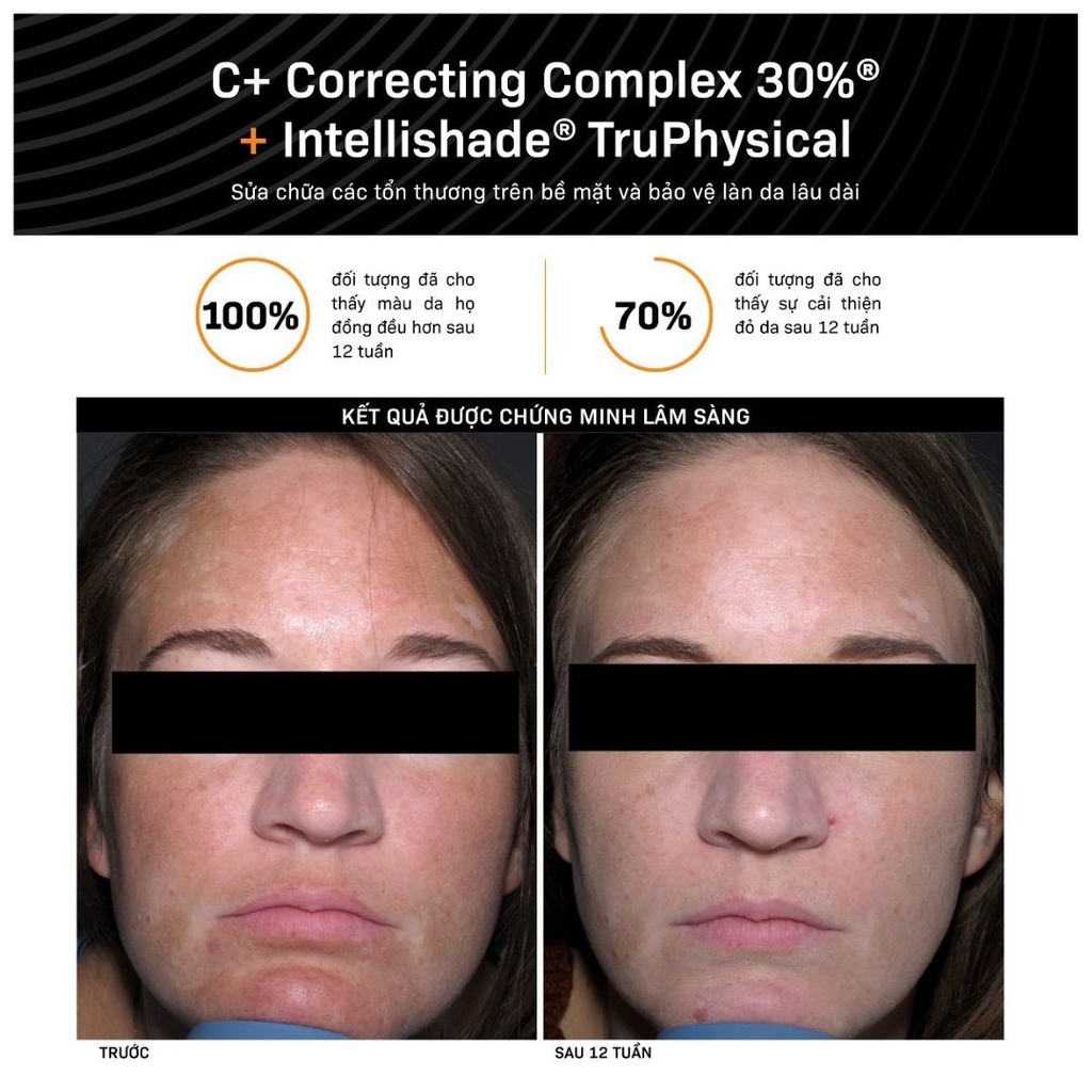 Serum Sáng Da & Chống Oxy Hóa Revision C+ Correcting Complex 30%®