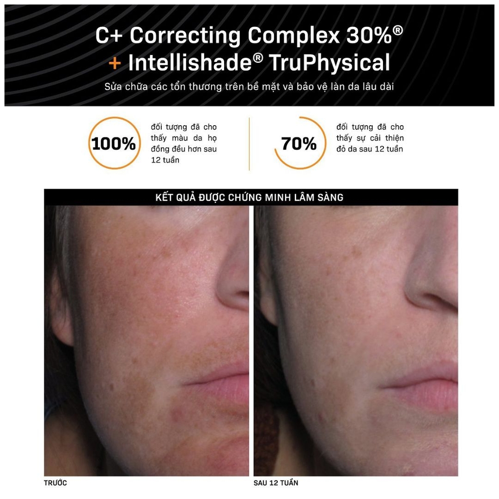 Serum Sáng Da & Chống Oxy Hóa Revision C+ Correcting Complex 30%®