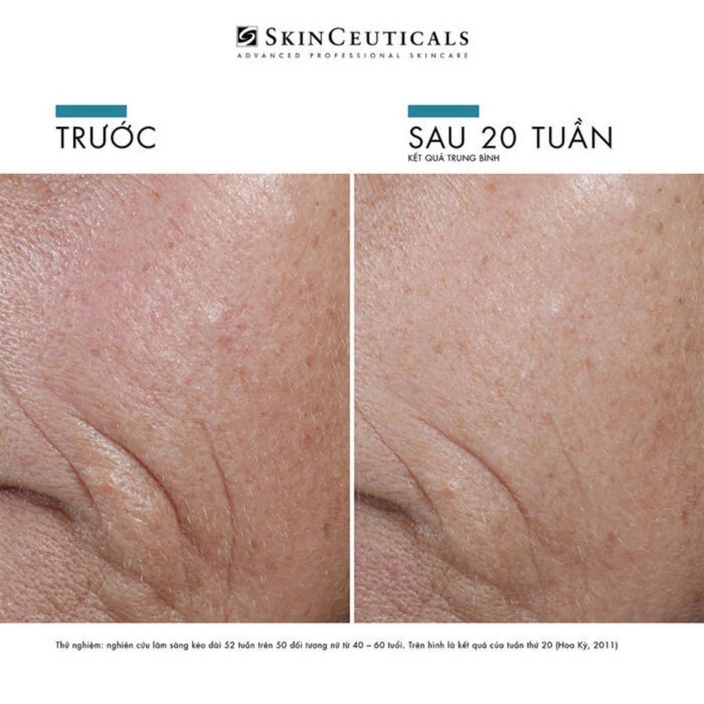 SkinCeuticals C E Ferulic® - Tinh Chất Chống Oxy Hóa Đột Phá (Vitamin C 15%, E 1%, Ferulic 0.5%)