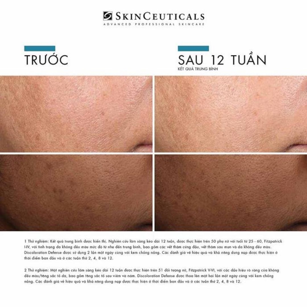 SkinCeuticals Discoloration Defense - Tinh Chất Chuyên Biệt Giảm Đốm Nâu & Thâm Mụn (Tranexamic Acid 3%)