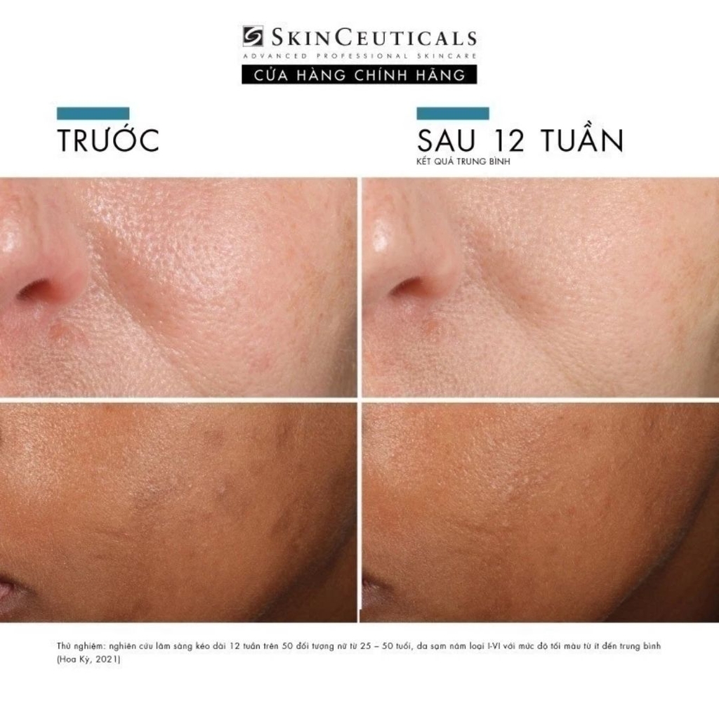 SkinCeuticals Phloretin CF - Tinh Chất Chống Oxy Hóa Bảo Vệ Da & Cải Thiện Sắc Tố (Vitamin C 10%)