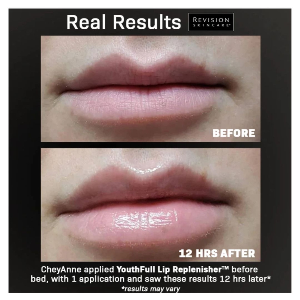 Son Dưỡng Căng Mọng & Mờ Rãnh Nhăn Revision Youthfull Lip Replenisher®