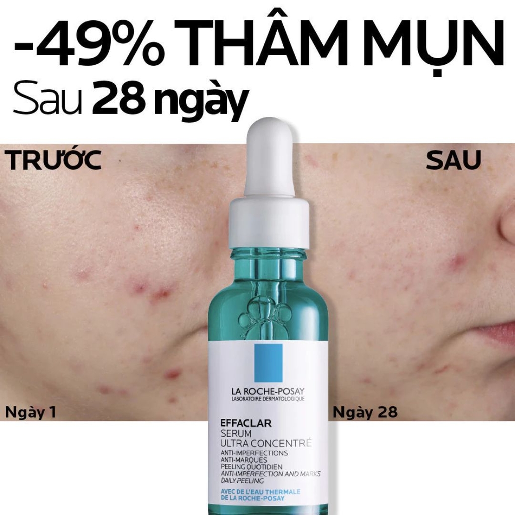 Tinh Chất Giảm Mụn & Thu Nhỏ Lỗ Chân Lông La Roche-Posay Effaclar Serum