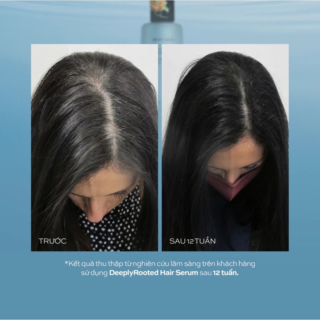 Tinh Chất Giảm Rụng Kích Mọc Tóc Hush & Hush DeeplyRooted Hair Serum