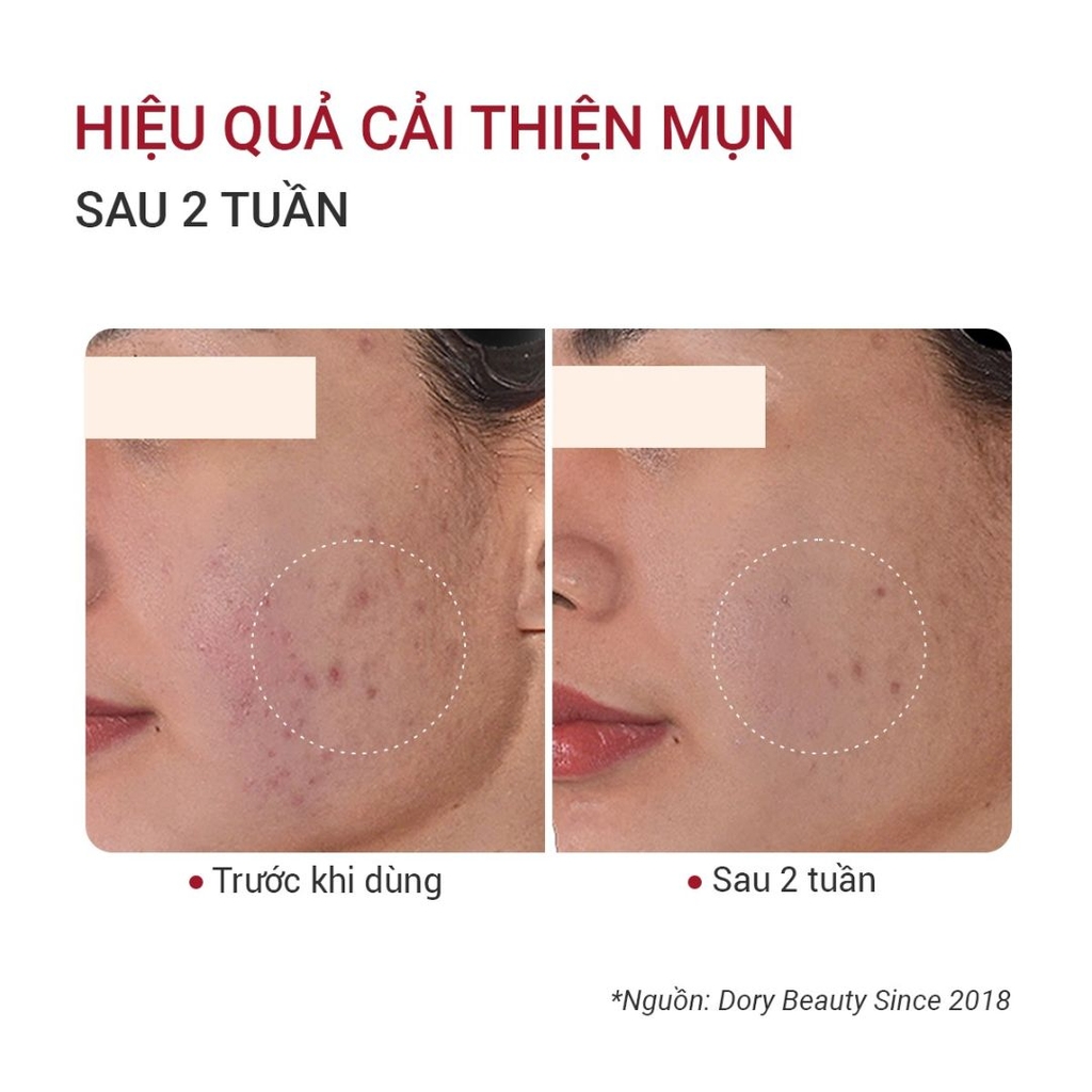 Tinh Chất Trẻ Hóa Da Fusion Retinol 1.0