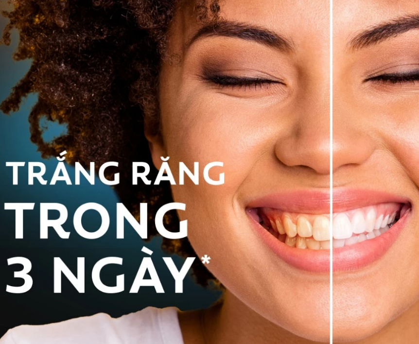 Kem Đánh Răng Colgate trắng răng TRONG 3 NGÀY Optic White O2 với Oxy Hoạt Tính 85g/ tuýp