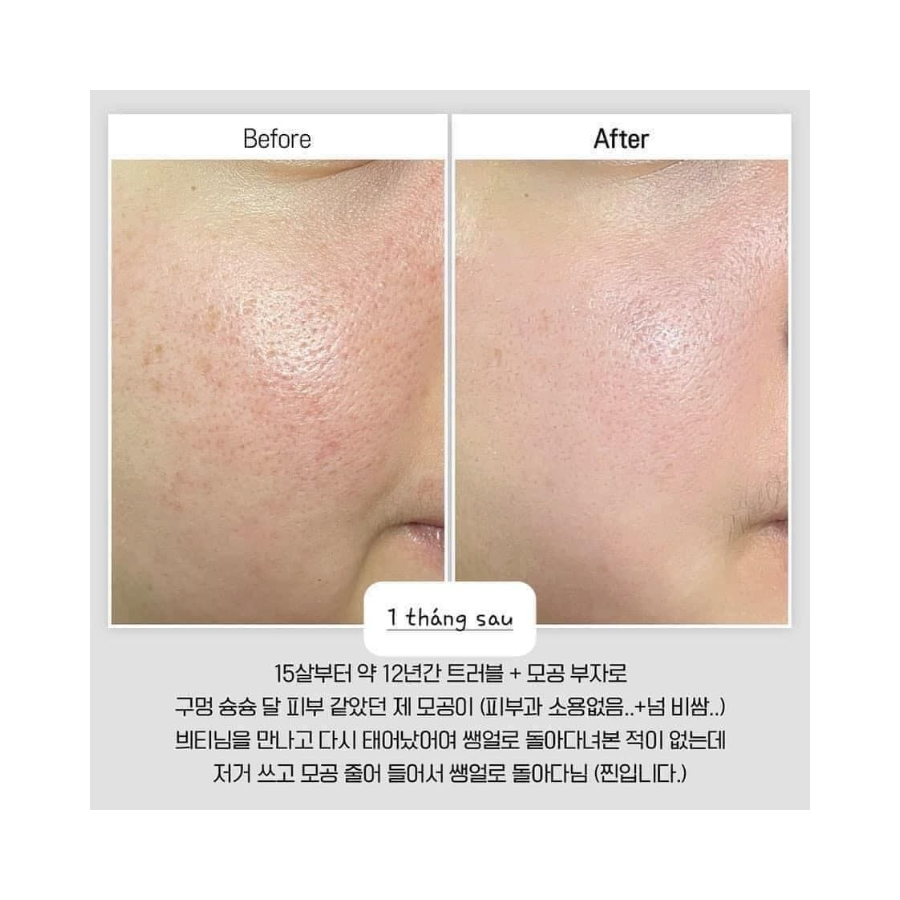 Vi Kim VT Reedle Shot 100 Essence 30ml Tách Set Nobox + Tặng Serum PDRN 1.5ml