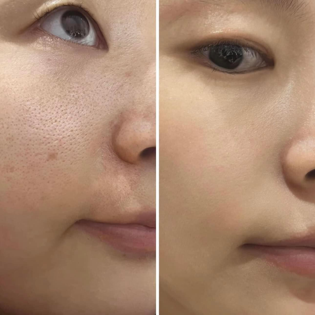 Serum Cà Chua Xanh Sungboon Thu Nhỏ Lỗ Chân Lông Editor Green Tomato Pore Lifting Ampoule+ 30ml (Tách set Nobox)