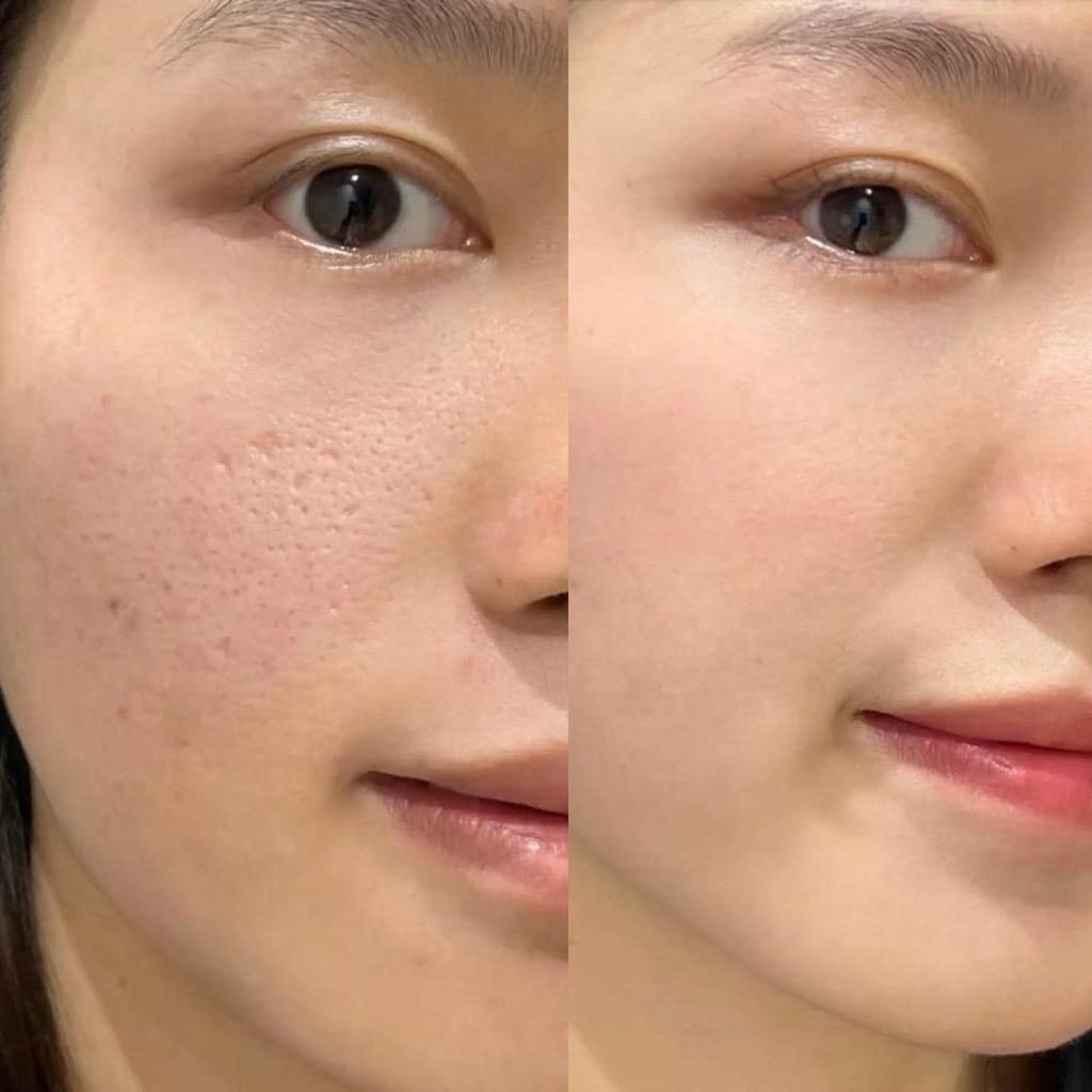 Serum Cà Chua Xanh Sungboon Thu Nhỏ Lỗ Chân Lông Editor Green Tomato Pore Lifting Ampoule+ 30ml (Tách set Nobox)