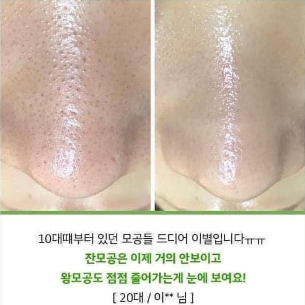 Serum Cà Chua Xanh Sungboon Thu Nhỏ Lỗ Chân Lông Editor Green Tomato Pore Lifting Ampoule+ 30ml (Tách set Nobox)