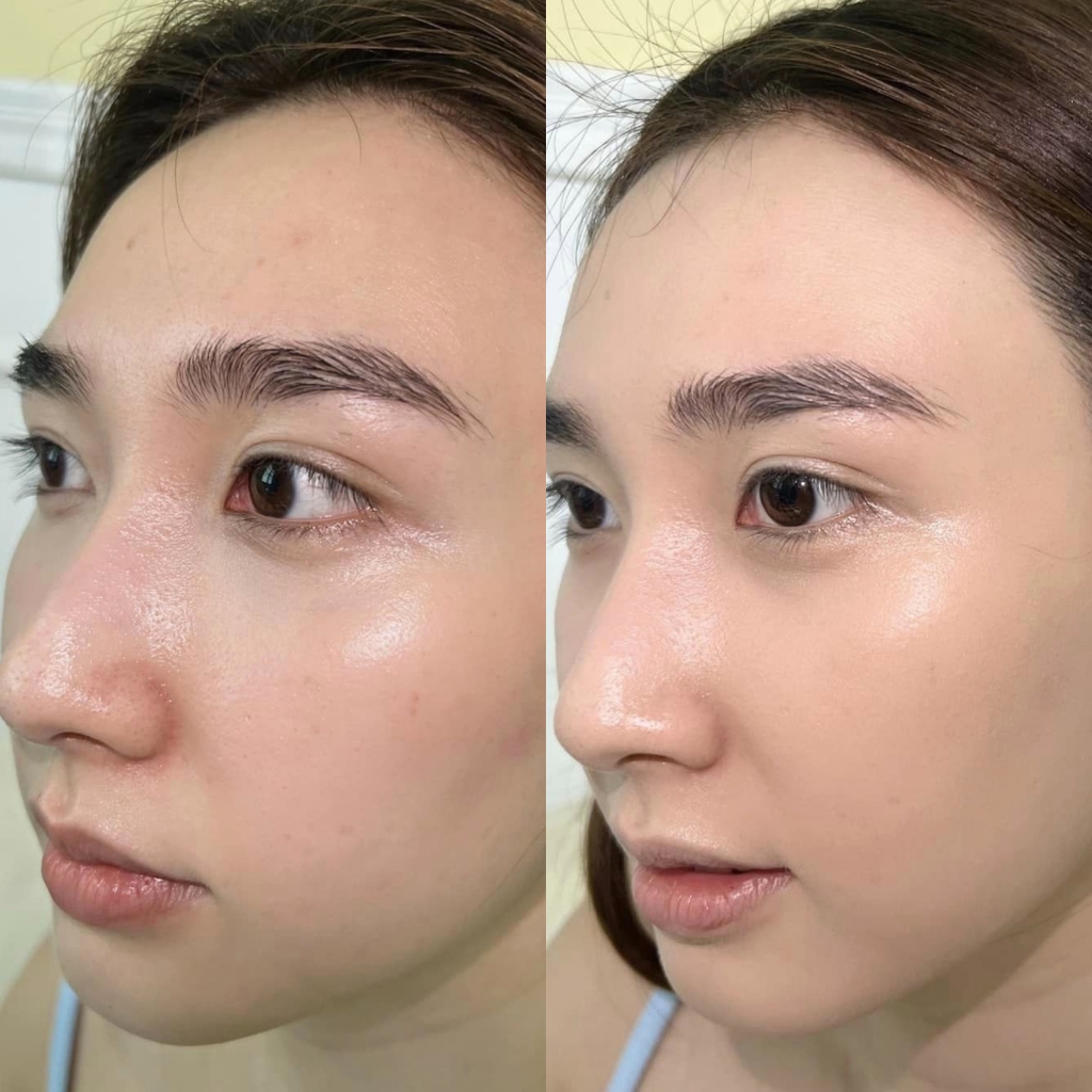 Kem phục hồi Martiderm Cicra-vass 30ml Fullbox Hàng Công Ty