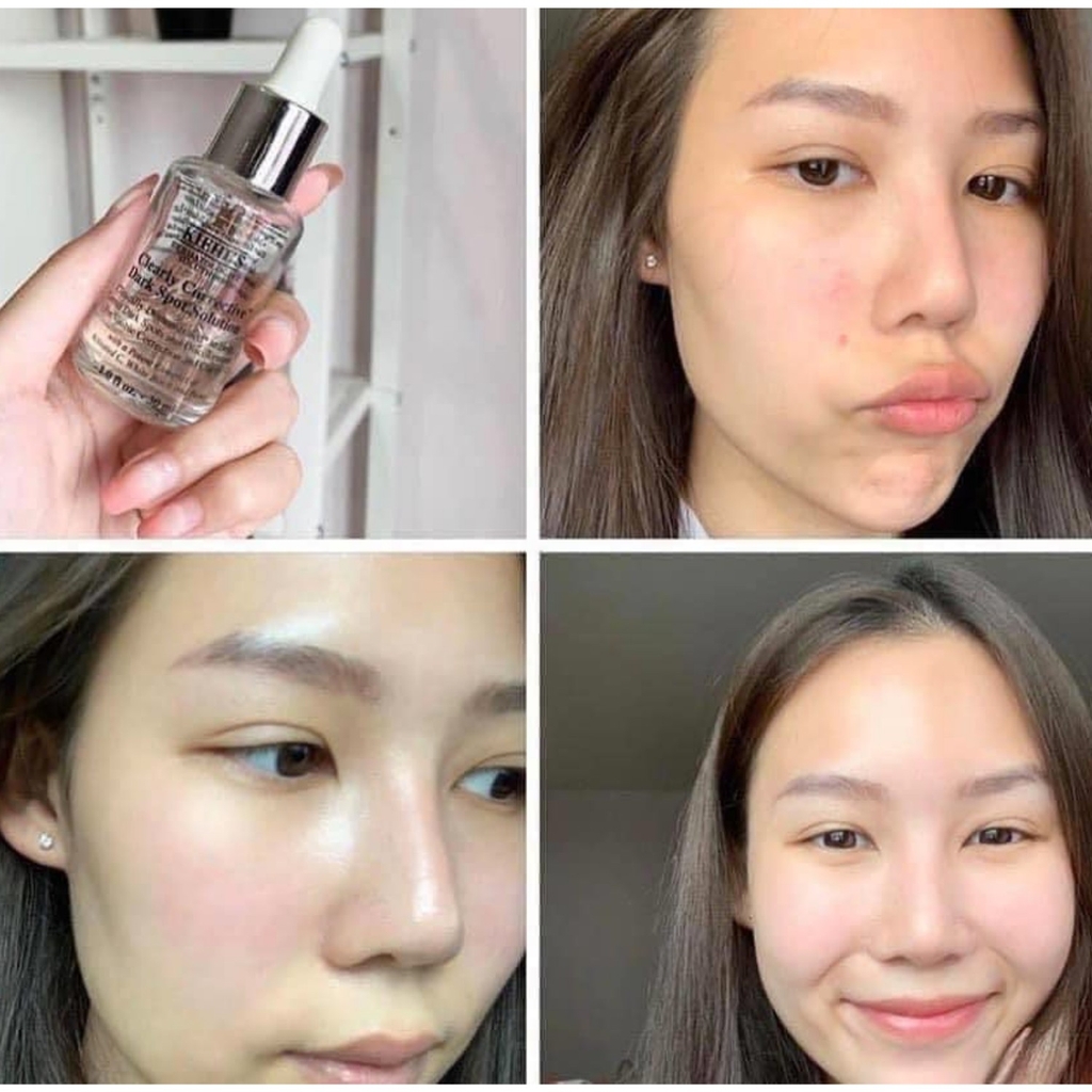 Combo 2 Serum Mờ Thâm Sáng Da Kiehl's The Dark Spot Duo Brightening 15ml x 2 CTY