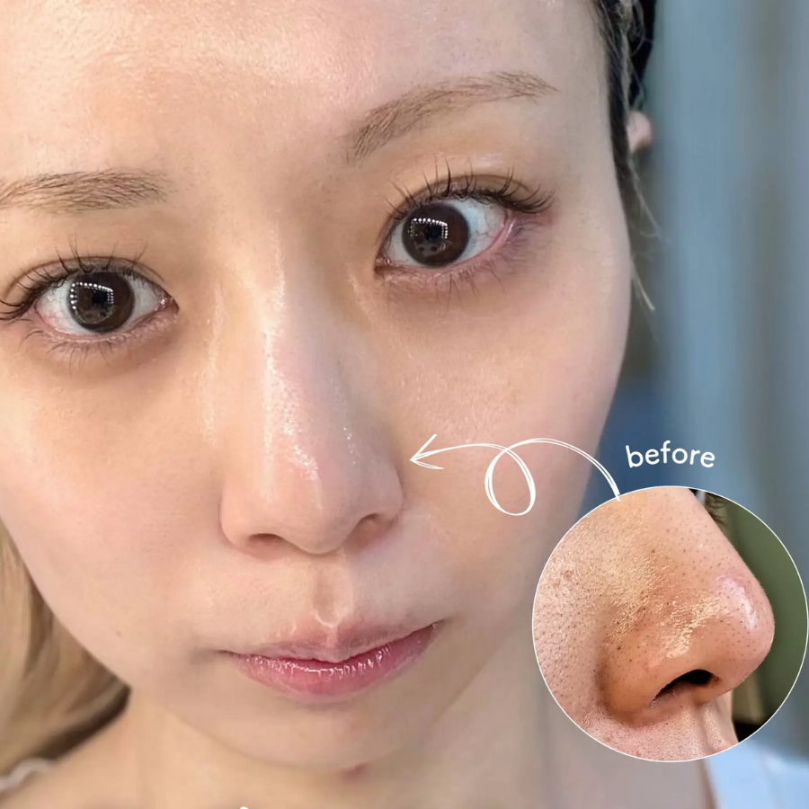 Toner 2% BHA Obagi Clenziderm M.D. Exfoliating 148ml - Hàng Công Ty