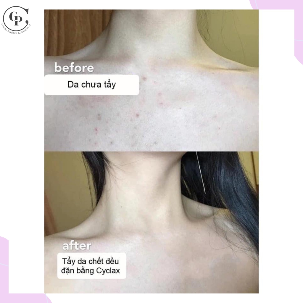 Combo 2 Tẩy tế bào chết Cyclax Nature Pure Facial Scrub Apricot 300ml x 2