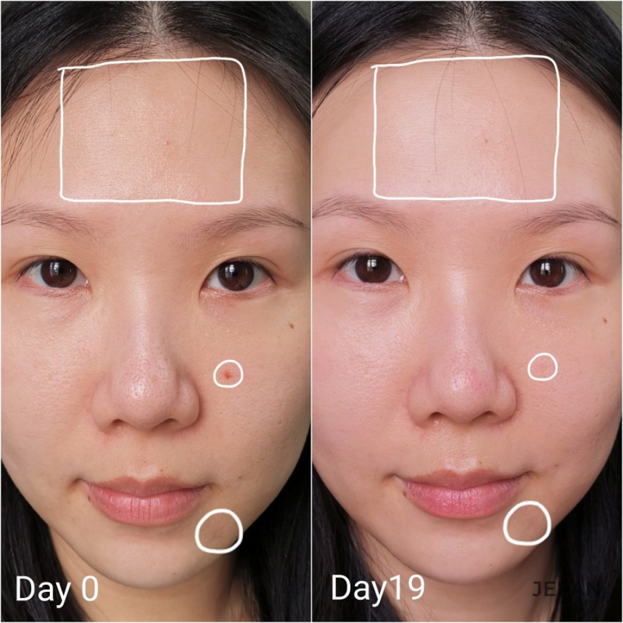 Tinh Chất Tái Tạo Da Kiehl’s Retinol Skin Renewing Daily Micro-Dose