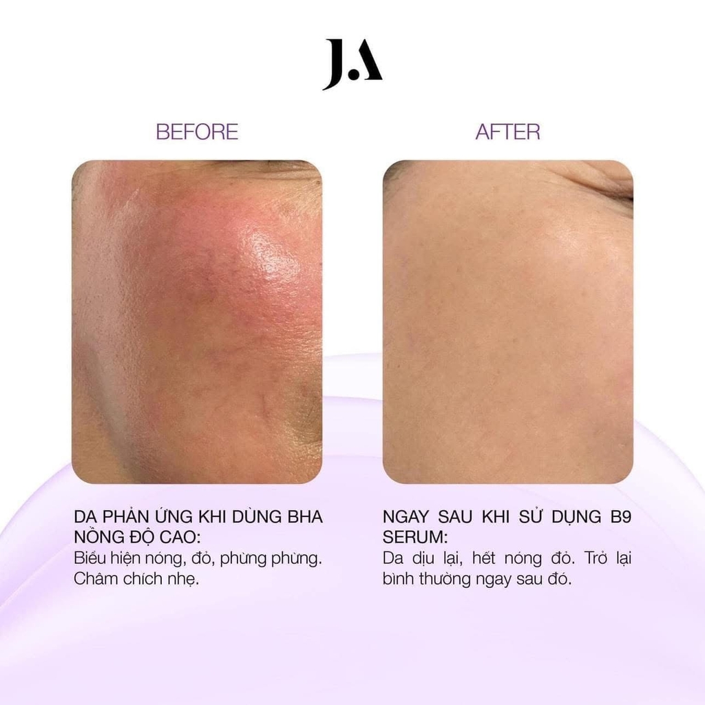 Serum B9 Juliette Armand Folic Acid 20ml giảm kích ứng phục hồi da - 20ml Fullbox - Hàng công ty