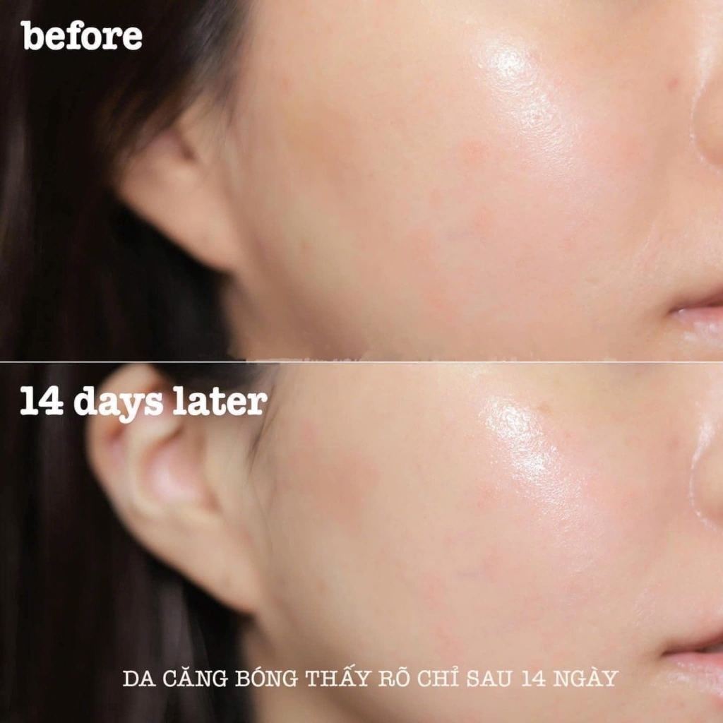 Combo 2 Hộp Collagen uống Elasten Đức - Giúp da căng mịn, chống lão hoá 28 Ống x 2 - Hàng Công ty