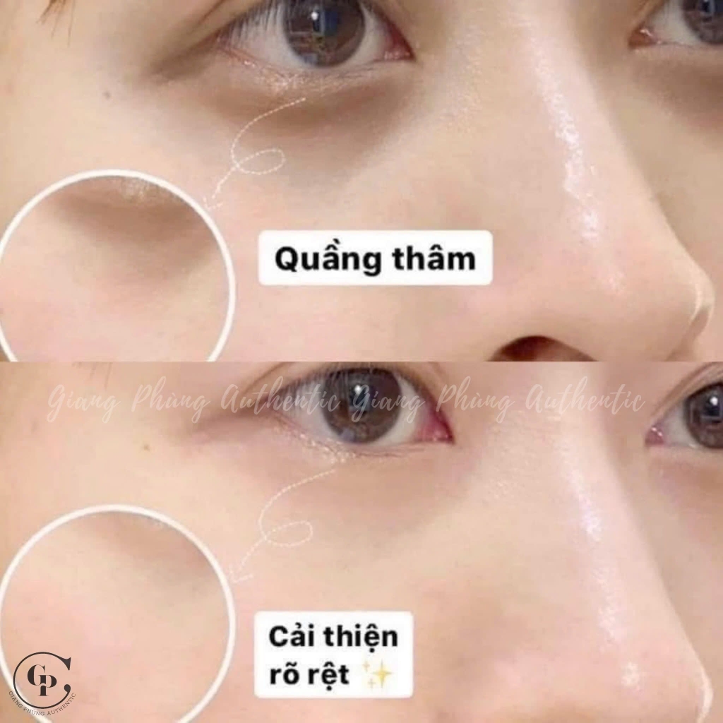 Combo 2 Kem mắt SKII Skinpower Eye Cream mini nobox 2.5g x 2 - Hàng công ty