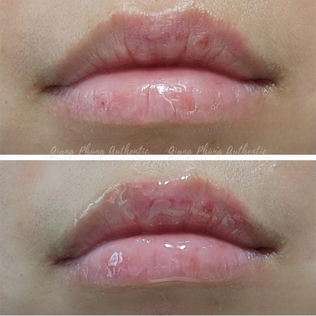 Combo 2 Tuýp Son Dưỡng Môi Không Màu Mario Badescu Lip Balm - Tuýp 10g Nobox