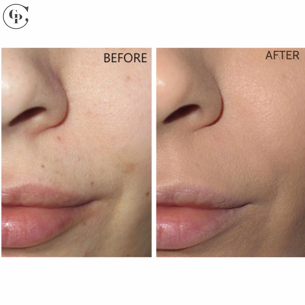 Che khuyết điểm Lancome Teint Idole ultra wear All over 13ml Fullbox Order US - 215 Buff(N ) Da Sáng, Da Trung Bình