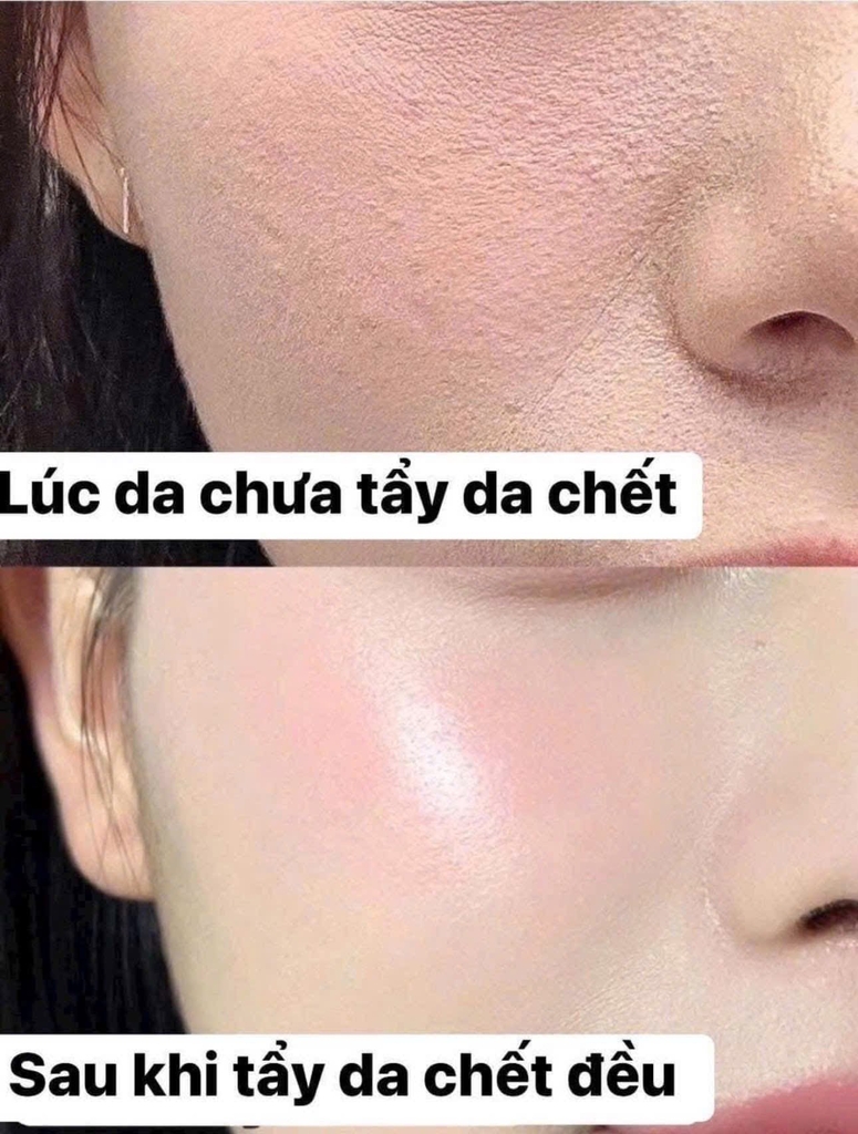 Tẩy da chết dạng gel Dr.G Brightening Peeling Gel 120g Tách set Nobox