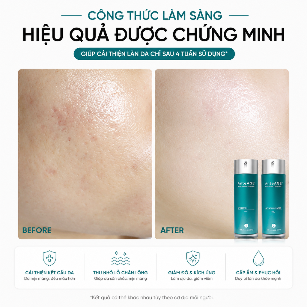 Bộ đôi Ante Age - Set Pro System (Serum 30ml+Accel erator 30ml)