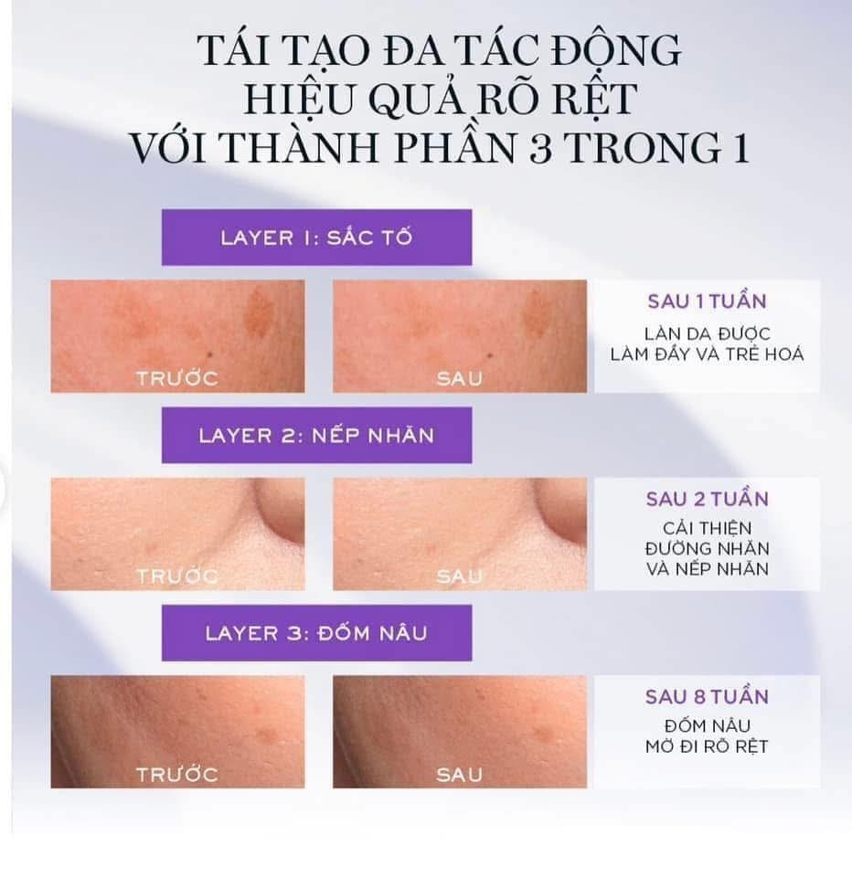 Tinh Chất Lancome Rénergie C.R.x. Triple Serum Retinol 50ml Fullbox - Hàng US