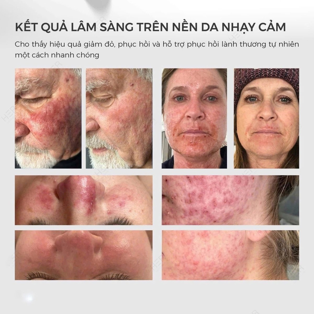 Xịt dưỡng Hydrinity Hyacyn Active Purifying Mist 90ml - Fullbox - Hàng Công Ty