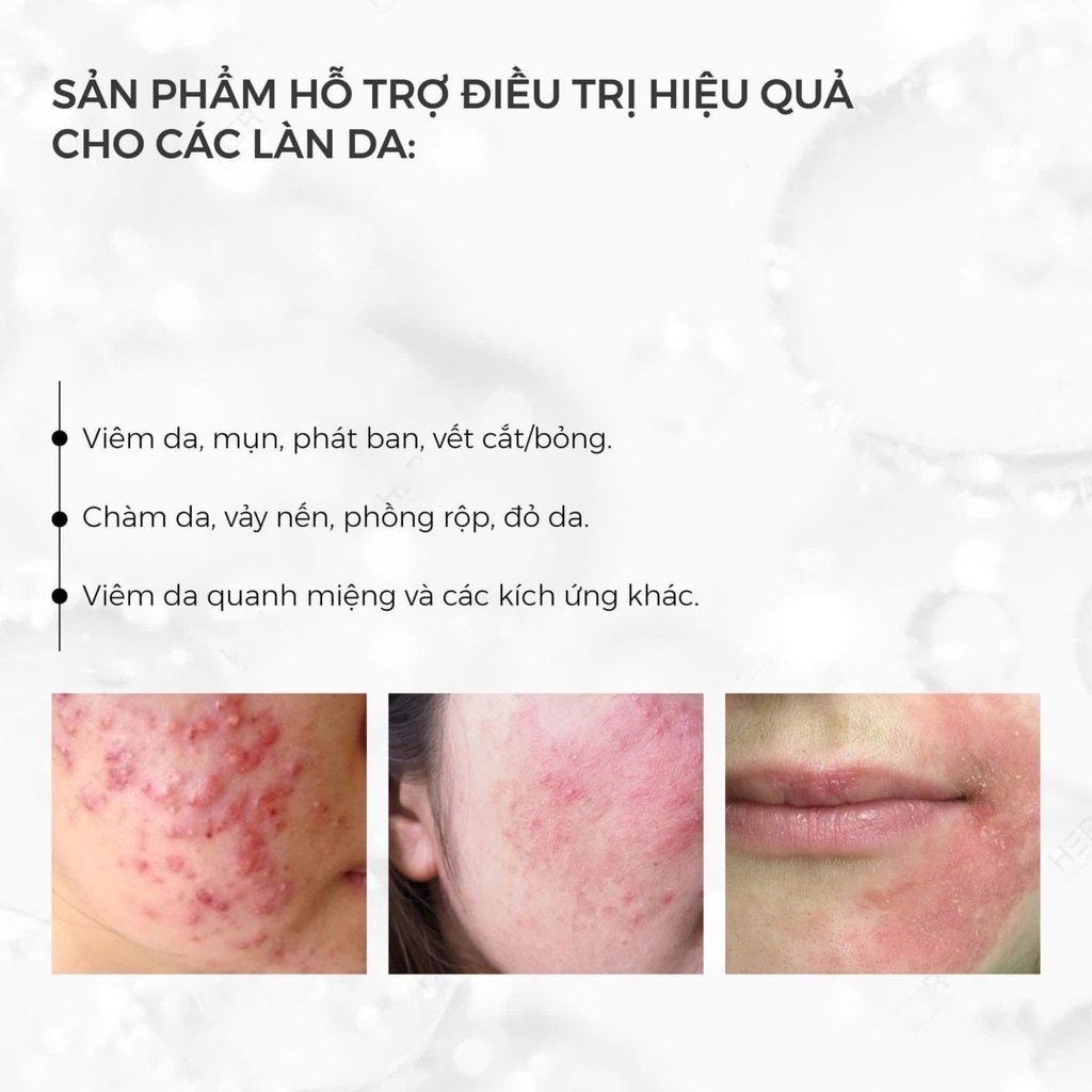 Xịt dưỡng Hydrinity Hyacyn Active Purifying Mist 90ml - Fullbox - Hàng Công Ty