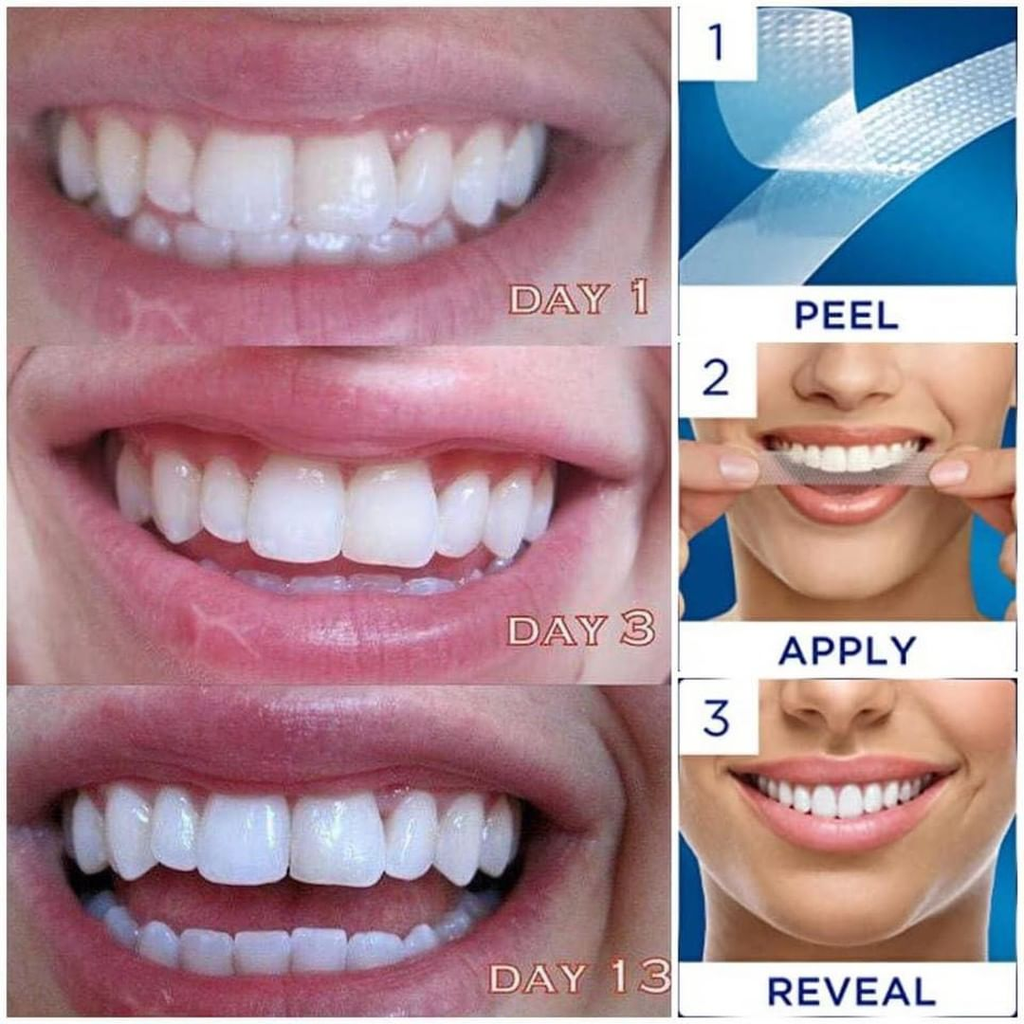 Dán răng Crest 3D Whitestrips Professional Effects Levels 19 whiter in 22 days - 44 strips Fullbox Order US