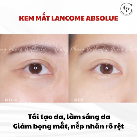 Kem mắt Lancome Absolue 5ml Fullbox - Tách set US